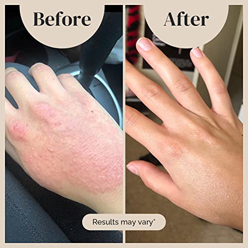 Puriya National Eczema Association Accepted Cream, Dry Itchy Skin Relief, Colloidal Oatmeal Lotion, Gentle on Kids, Adults, Face, Hands, Mother of All Creams, Plant-Based Hydration, No Fragrance Added - Image 5