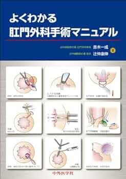 主要外科手術の要点 m3電子書籍 | 整形外科 Knack & Pitfalls 整形外科手術の要点と盲点