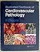 Illustrated Textbook of Cardiovascular Pathology