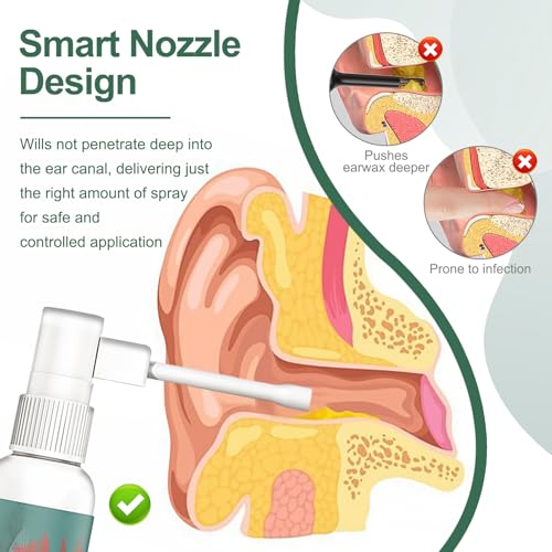 4 Pcs Ohrenschmalz Entferner Spray, 30 ml OhrenreinigerSpray, Sanfte Cerumenolytika, Innitus Relie Spray, Ohrenspray Gegen Ohrenschmalz zur Täglichen Ohrpflege,Verhindert Ohrenschmalzansammlung
