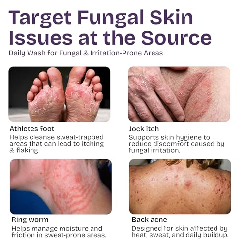 Antifungal Body Wash with Tea Tree Oil | Eczema Body Wash Treats Ringworm, Back Acne & Jock Itch | Antifungal Soap For Men And Women with 1% Tolnaftate Detail