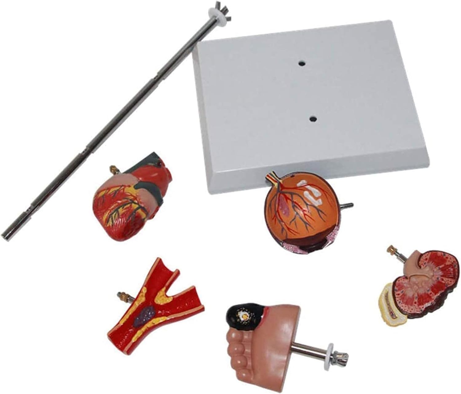 Modèle d'organe du diabète - Modèle d'anatomie médicale Modèle de diabète - Modèle Scientifique d'anatomie Humaine Amovible - for l'éducation et la Formation médicales