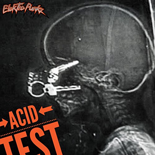 Acid Test 2017