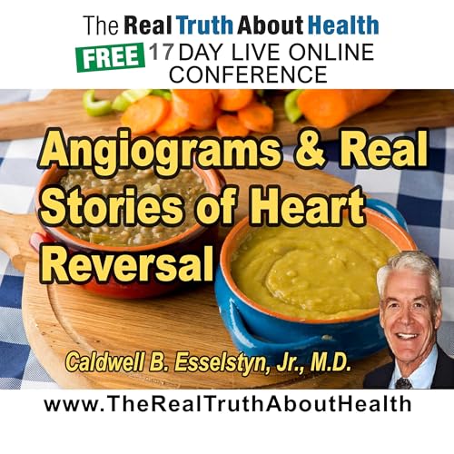 Angiograms and real stories of heart reversal