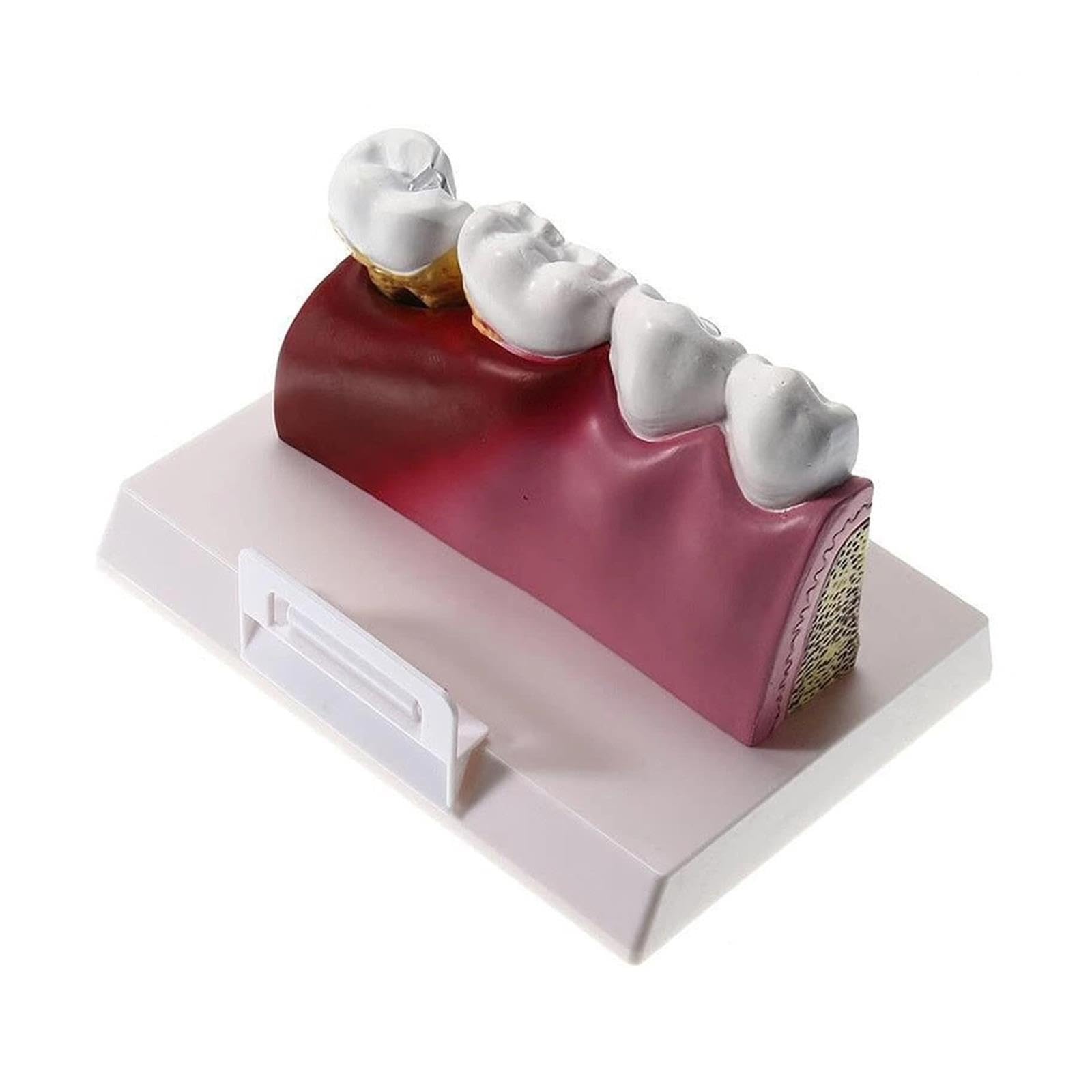 Anatomia dentale Educazione Modello Dente