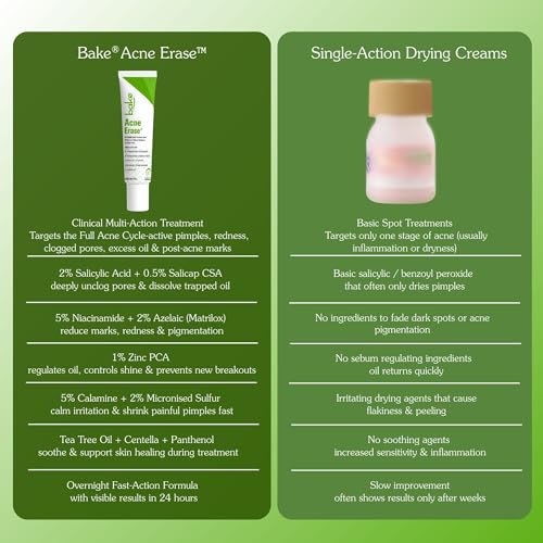 Image of BAKE Acne Spot Treatment Serum Gel with 2% Sulfur, 2% Salicylic Acid + 0.5% Salicap CSA for Pimples & Breakouts | 5% Niacinamide + 2% Azealic Acid | Clears Blackheads, Whiteheads & Clogged Pores | Reduces Redness & Excess Oil | Overnight Acne Corrector - 30g