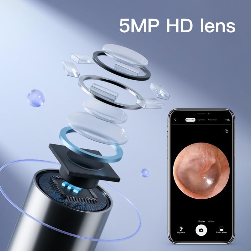 V88R®Ear Wax Removal CleanerTool,Wireless Otoscope,Ear Cleaner with Camera,1080P FHD Video Otoscope Compatible with iPhone & Android, Video Suitable for Kids, Adults & Pets 3
