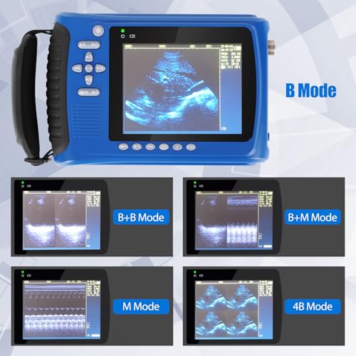 ultrasound machine smart 1029