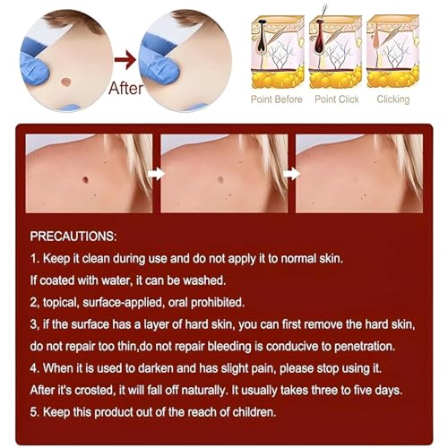Image of Pack of 2 Wart, Ointment, Skin Tags & Moles Remover For Face & Body | Massa & Ointment Remover For All Skin | Skin Tag Remover - Fast, Easy & Effective Formula for All Skin Type (2 Units)