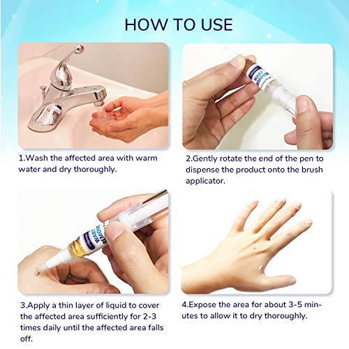 Samsali Wart Remover, Maximum Strength, Easy and Painless Wart Remover, Removing all Kinds of Common Warts, Best Wart Remover for Removing Warts