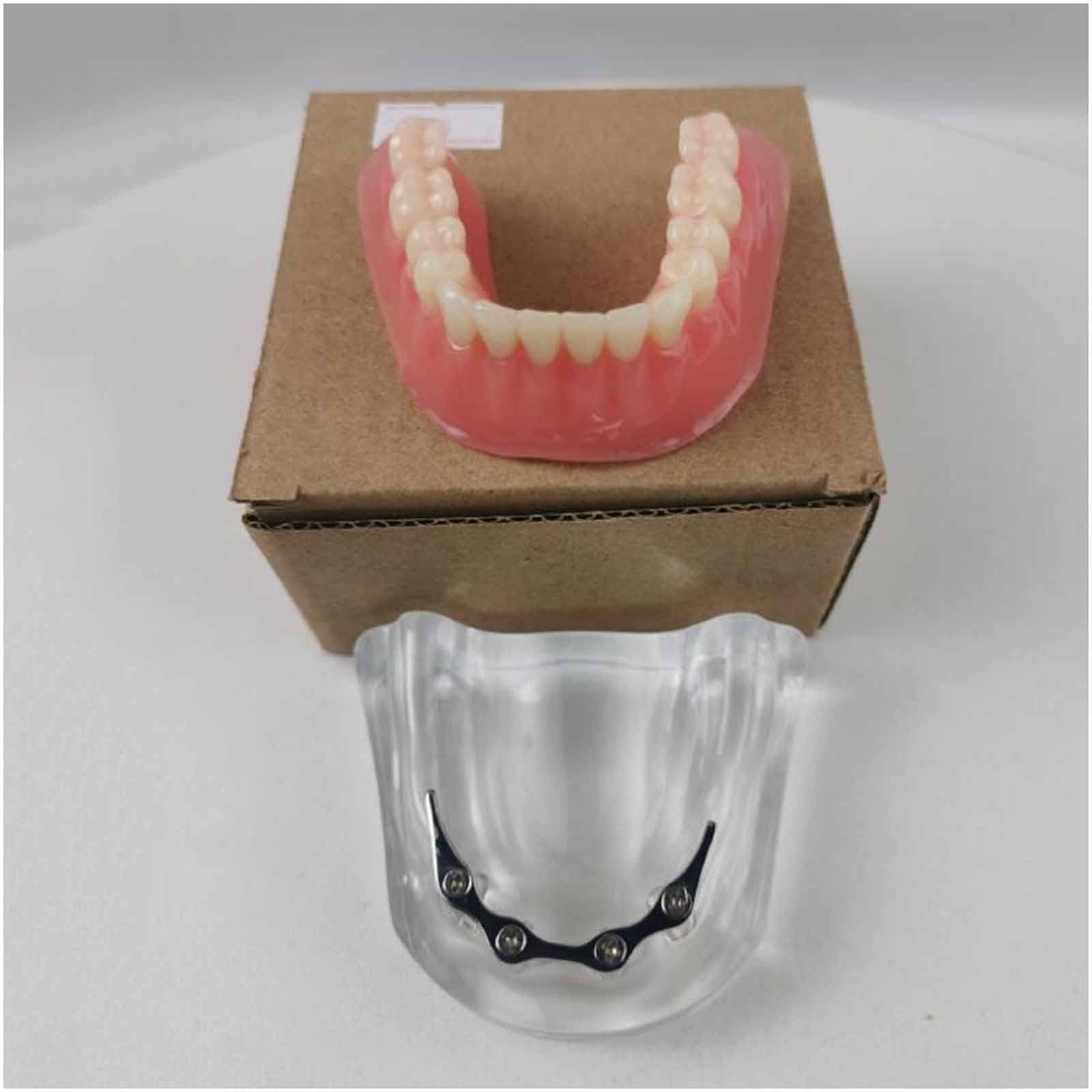 Model demonstracyjny zębów, wyjmowany implant, analiza, model odbudowy zębów do nauczania zębów lub pielęgnacji jamy ustnej
