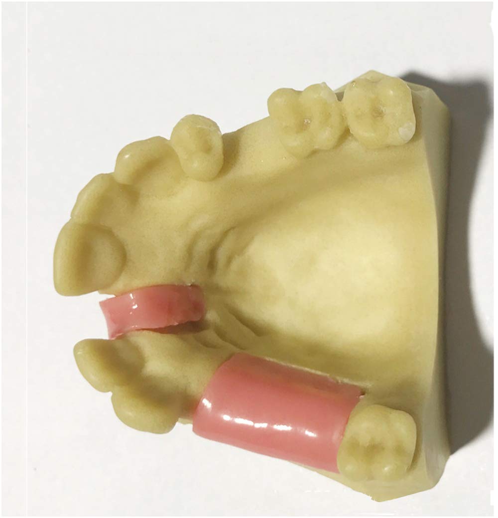 Sjdopulse A Maxillary Missing Tooth Model - Dental Teeth Study Teaching Model - Dental Implant Nail Placement Training Practice Teeth Teaching Model - For Study Teaching Display (A)
