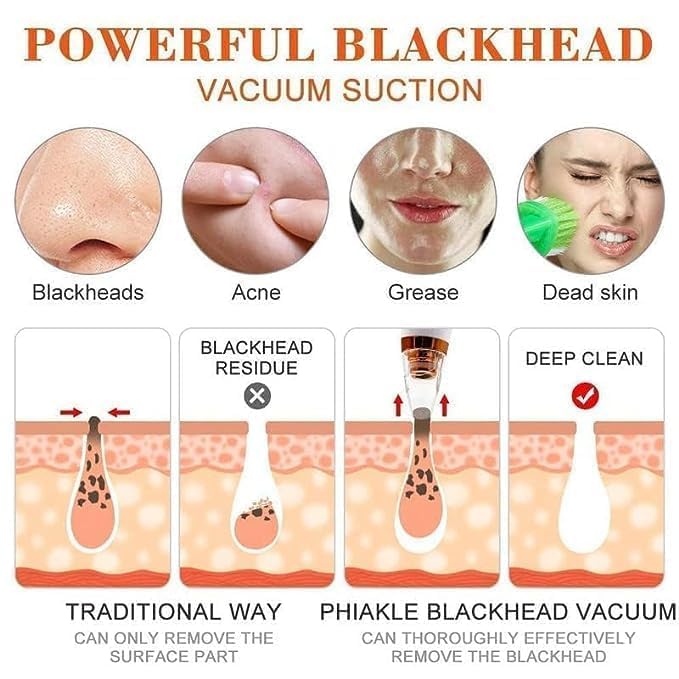 Image of 6 in 1 Multi-function Blackhead Remover Tools | Electric Derma suction Machine | USB Rechargeable Acne Pimple Pore Cleaner Vacuum tool - Facial Cleanser Device for Nose & Skin Care