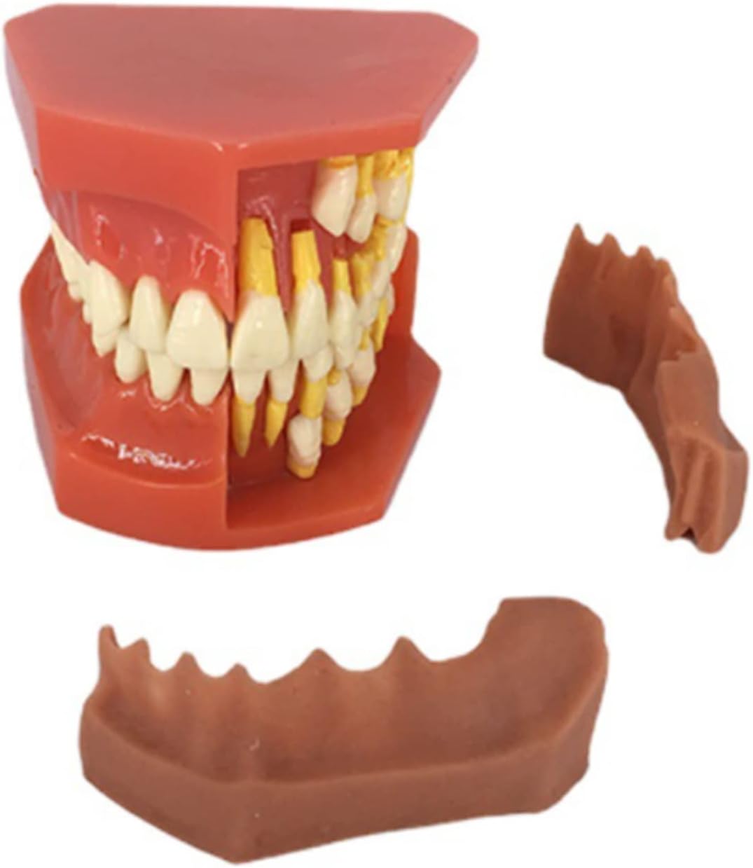 Milk Teeth Model, Detachable Teeth Eruption Development Model, Alternate Display Model of Oral Primary and Permanent Teeth for Doctor Patient Communication Model Teach Demo