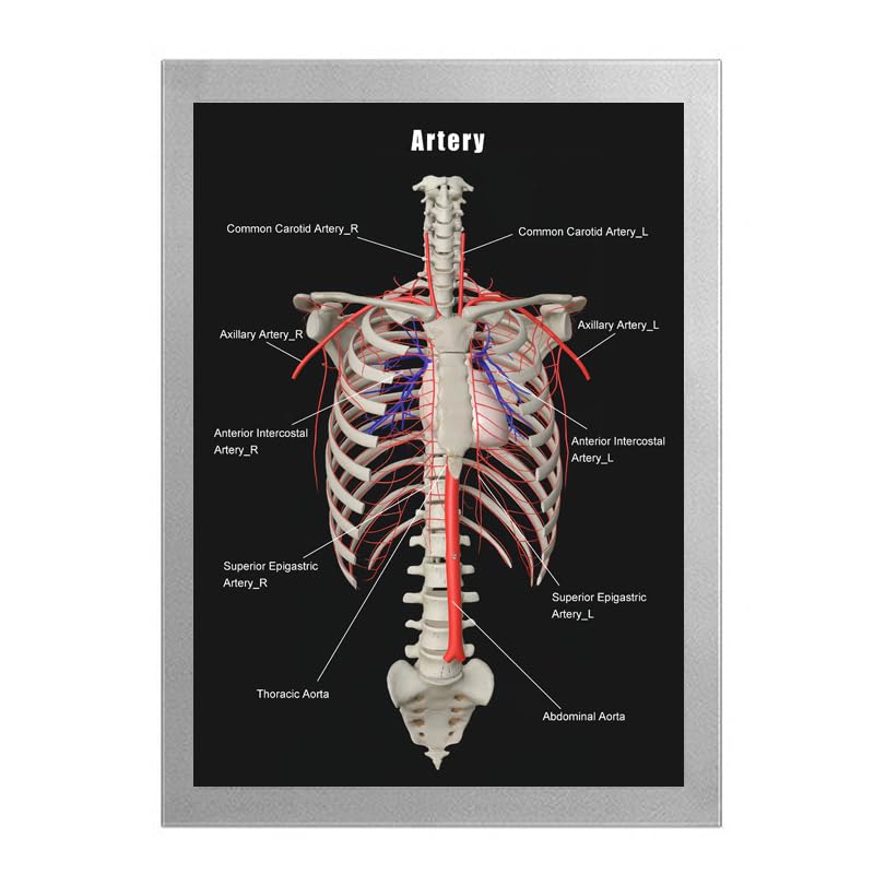 Image of Taanfu Body Educational Learning Anatomy Posters ，Arterial skeleton Art Arterial Villi Anatomy Art Poster Digestive System Organs Illustration Small Intestine Physiology Anatomy Wall Art Villi
