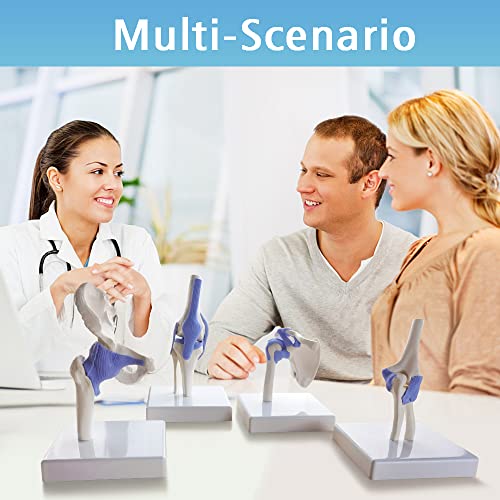 Image of EVOTECH SCIENTIFIC Mini Shoulder Knee Hip Elbow Joint Model Set, 1 /2 Life Size Human Joint Anatomy Replica Set of Shoulder Knee Hip & Elbow Joints for Medical Education Study Clinic Demonstration Tool