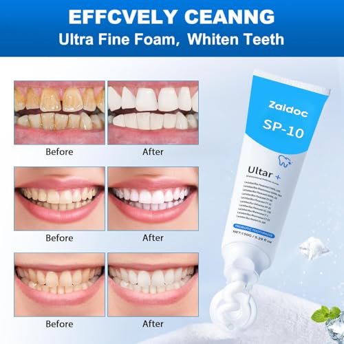 Image of 2-Pack SP-10 Probiotic Toothpaste, Mint Flavor for Fresh Breath, Tooth Care, Plaque Control & Sensitive Teeth, 5.29 Oz*2