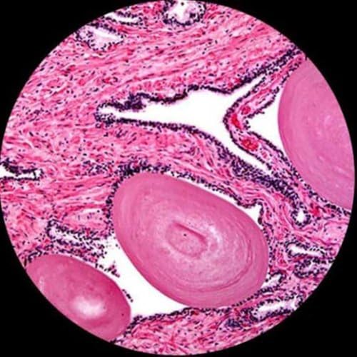 Image of AmScope T360B-10M Digital Trinocular Compound Microscope, 40X-2000X Magnification, WF10x and WF20x Eyepieces, Brightfield, LED Illumination, Abbe Condenser, Double-Layer Mechanical Stage, Includes 10MP Camera with Reduction Lens and Software