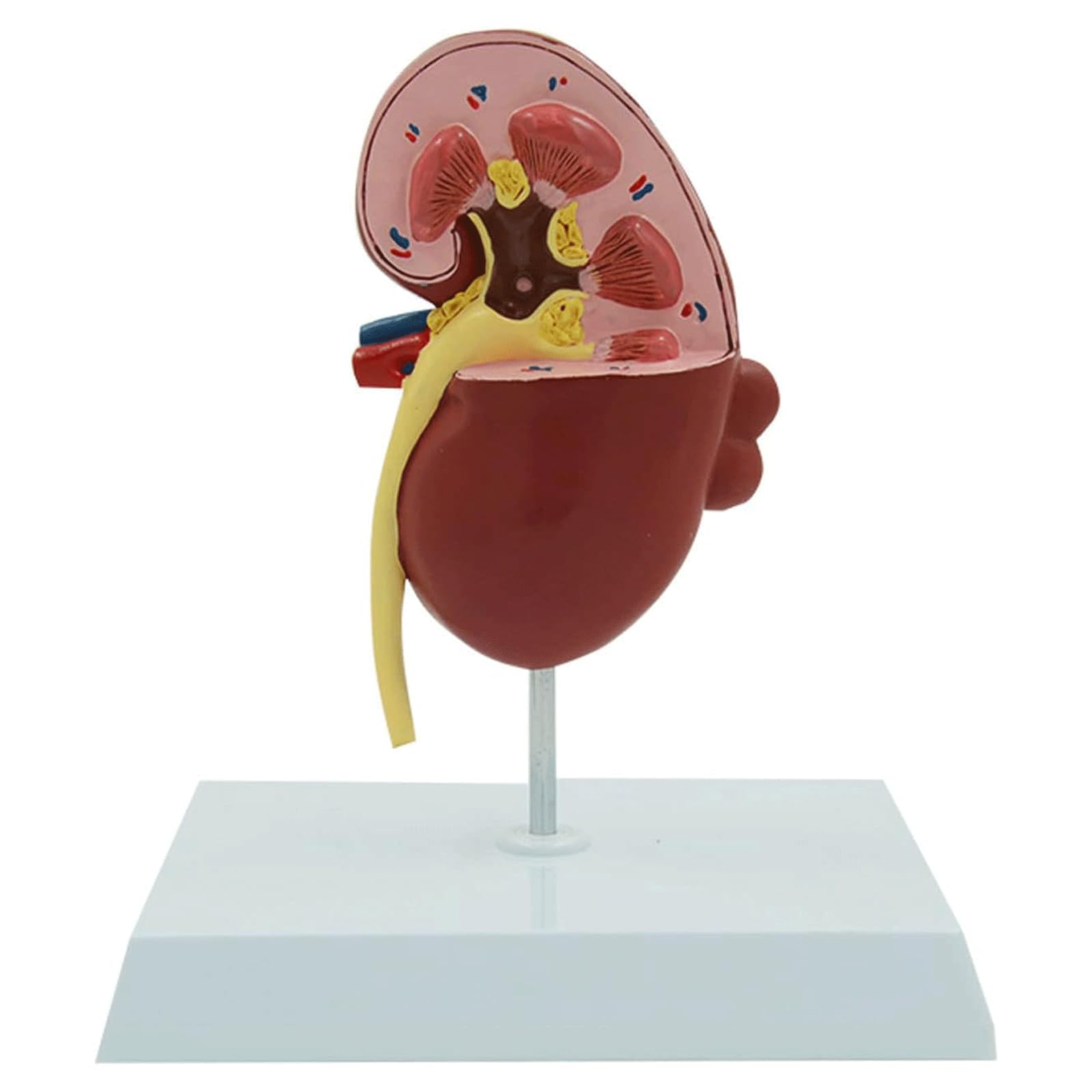 FROON Human Renal Anatomy Model Pathological Kidney Model Professional Organ Model as Medical Teaching Aids