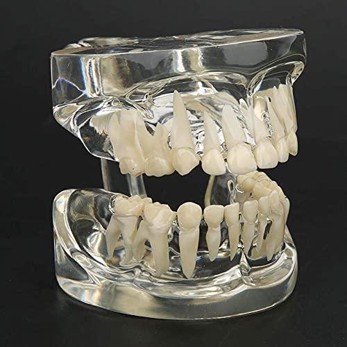 WAITLOVER Standaard Tandheelkundige Tanden Model,Kind Tanden Onderwijs,Tandziekte Onderwijs Studie Volwassen Typodont… - Image 8