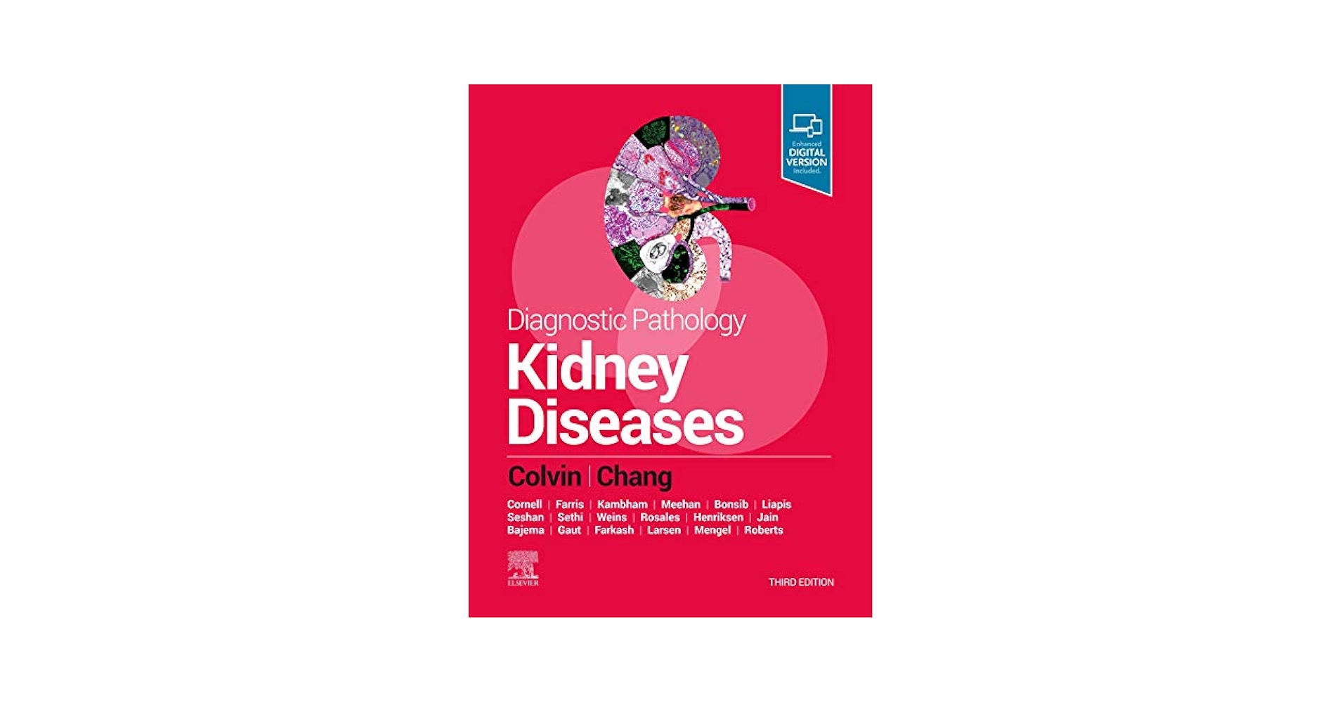 健康・医学 Diagnostic Pathology Kidney Diseases Diagnostic Pathology: Kidney Diseases: 9780443107177