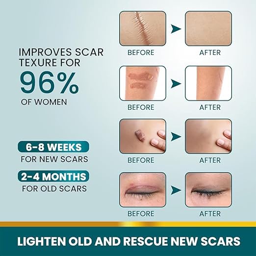 Scar Removal Tape Scar Removal Sheet Strips for C-Section Get Scars Away Painless Reusable
