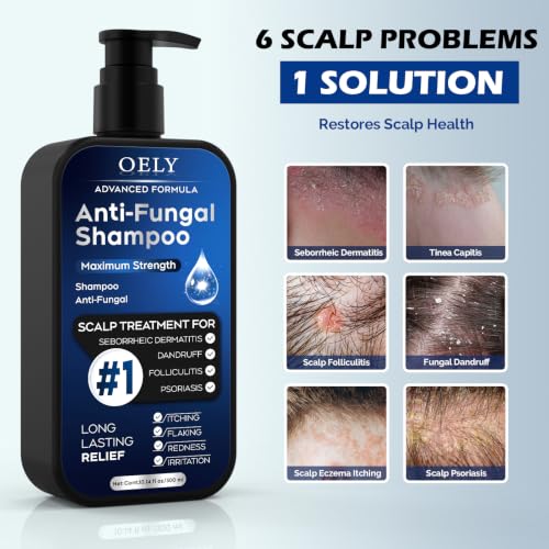 Image of Antifungal Shampoo for Seborrheic Dermatitis, Folliculitis - Fresh | Scalp Psoriasis & Anti-Dandruff Shampoo for Men & Women, Relieves Scalp Itching, Dryness, Sulfate & Paraben-Free, 10.1 Fl Oz