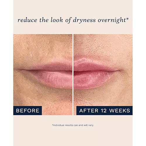 Miniatura 2 de City Beauty City Lips - Aceite nocturno para rellenar, hidratar y restaurar durante la noche, tratamiento labial antienvejecimiento, aceite labial