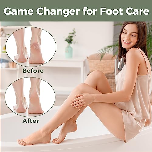 Image of Foot File Foot Scrubber Pedicure - Callus Remover for Feet Easkep Professional Grater Rasp Foot Scraper Corns Callous Removers Cracked Dead Skin Remover for Dry and Wet Feet (Grey Green)