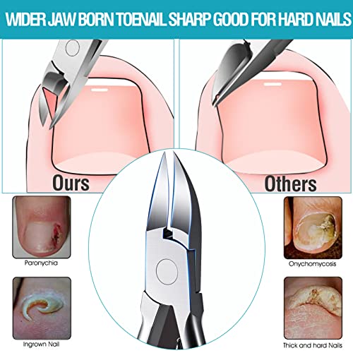 TOKINGO Nail Clippers Kits, Heavy Duty Professional Toenail Clipper for Ingrown Thick Nails, Birthday Gifts for Men Women, Pedicure Tool,Nail Cutter, Manicure Set(5PCS Gift Box Set) - Image 3