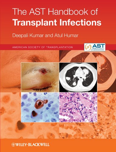 Wiley-Blackwell Kumar, Deepali The Ast Handbook Of Transplant Infections cover