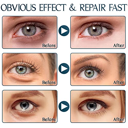 Under Eye Patches (60Pcs), Aloe Vera & Collagen Eye Mask, Eye Patches For Puffy Eyes, Anti-Aging Eye Mask For Puffiness, Under Eye Mask For Dark Circles And Eye Bags, Hydrating Eye Gel Pads #TOP2