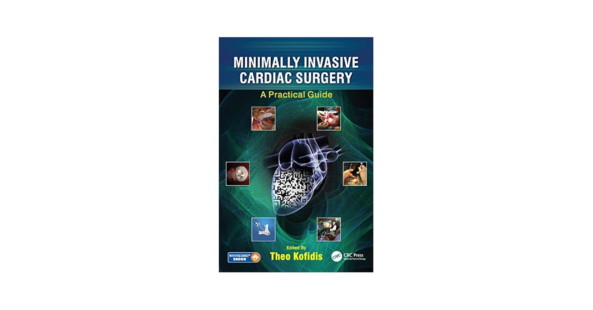 Minimally Invasive Cardiac Surgery: A Practical Guide