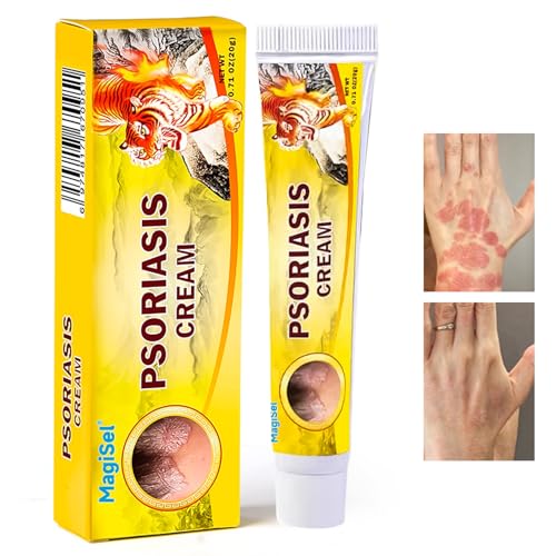 Creme per la Psoriasi, Crema Idratante 20g Crema per l'eczema