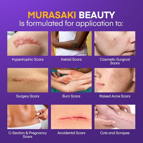 Image of Silicone Scar Gel Scar Cream: SPF 30 Advanced Medical-Grade Formula for Surgical Scars, C-Section, Stretch Marks, Acne, Burns, Keloids, Old & New Scars - Broad Spectrum UV Protection 1.06oz (30g)