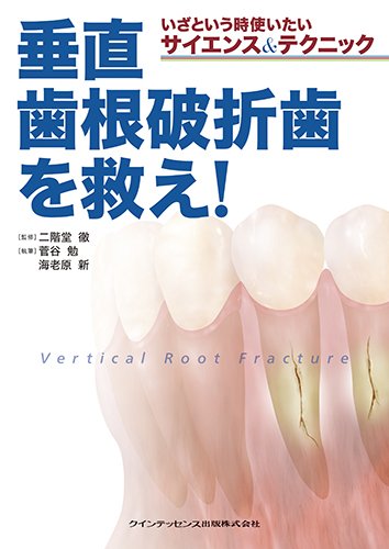 歯牙破折の分類・診査・診断・マネージメント: 世界の標準的なガイドラインと歯内療法専門医の臨床から学ぶ Amazon.co.jp: 歯牙破折の分類・診査・診断・マネージメント