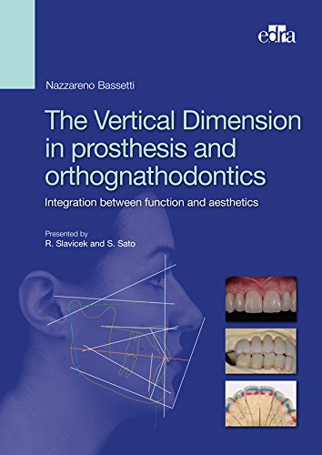 The Vertical Dimension in prosthesis and orthognathodontics: Integration between function and aesthetics (English Edition)