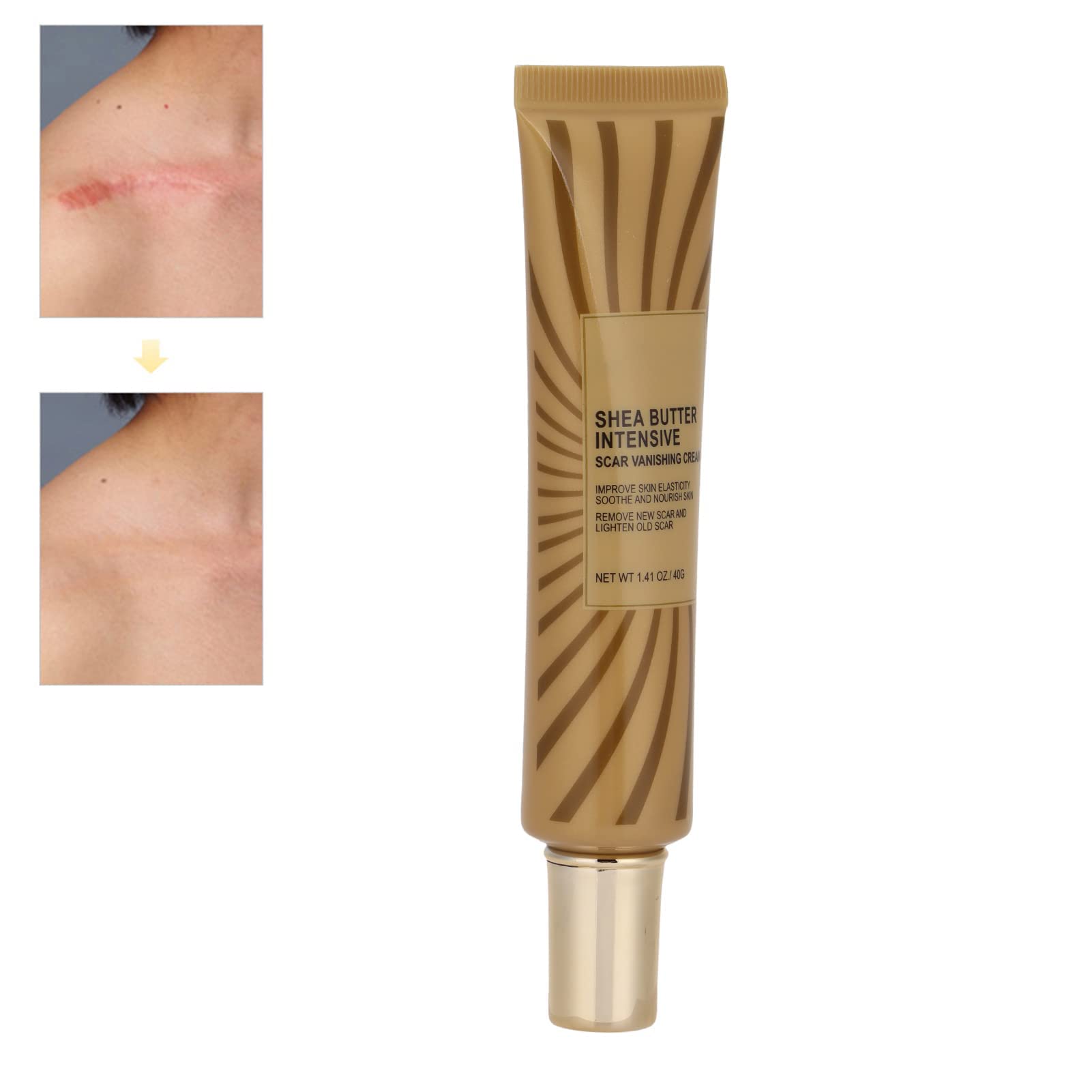 Scar Cream, Scars Removal Cream Suitable for Accelerating Wound Healing Burns and Scars Rich in Nutrients to Repair Damaged Elastic Collagen Fibers Remove Scars
