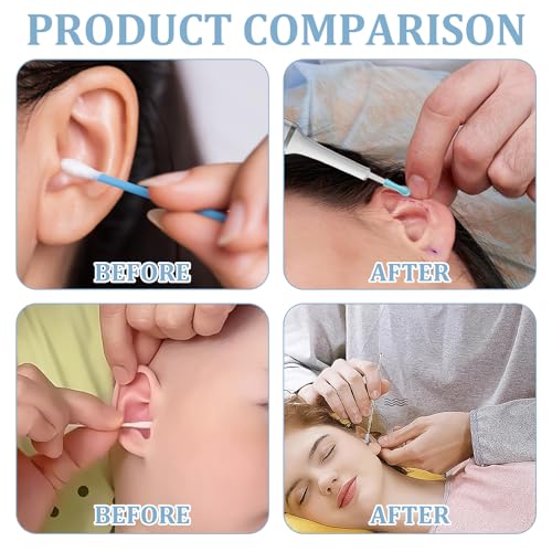 60 Pcs Ohrenkerzen Ohrreiniger FüR Erwachsene Ohrenschmalz Entferner Ohrenkerzen Ohrreiniger FüR Erwachsene Ohrenschmalz Entferner Sanftes Silikonmaterial FüR Eine Effektive Reinigung Von Ohrenschmalz