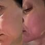 Rodan + Fields Pure C Serum | 10% Ascorbic Acid Vitamin C Formula for Refined-Looking Skin | Antioxidant Support for Daily Skincare | Water-Free Formula | Non-Comedogenic Facial Serum