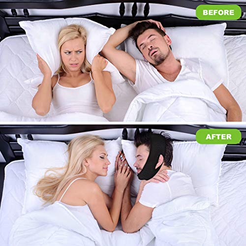 Anti Snoring Chin Straps, Anti Snoring Devices, Ajustable Stop Snoring Solution Snore Reduction Sleep Aids, Snore Stopper Chin Straps Snore Relief for Men Women Snoring Sleeping Mouth Breather