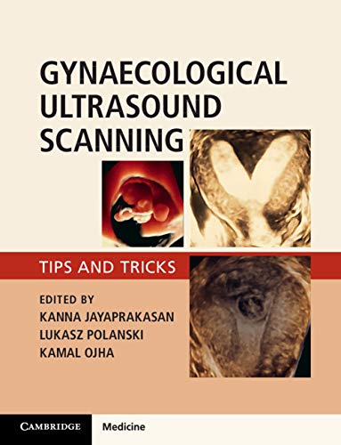 Gynaecological Ultrasound Scanning: Tips and Tricks (English Edition)