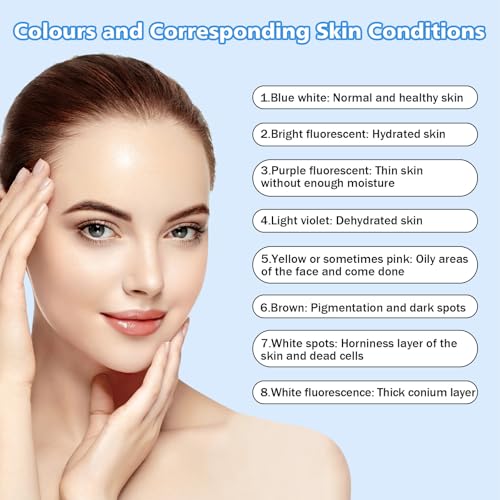 Portable Lamp, Lamp Magnifying Analyzer, Handheld Lamp Light Detecto for Care of Ringworm Detection, Pet Dogs, Cats,SPA, Salon, Home Use