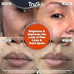 TruSkin Vitamin C Serum For Face – Anti Aging Face Serum with Vitamin C, Hyaluronic Acid, Vitamin E – Brightening Formula – Improve Appearance of Dark Spots, Tone, Fine Lines & Wrinkles, 2 Fl Oz - Image 4
