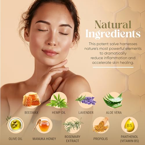 Manuka-Honig-Hanf-Salbe für Neurodermitis & Ekzeme, Schuppen - Propolis, Bienenwachs, Aloe Vera- Dermatologisch Empfohlen, Heilt Trockene, Rissige Haut