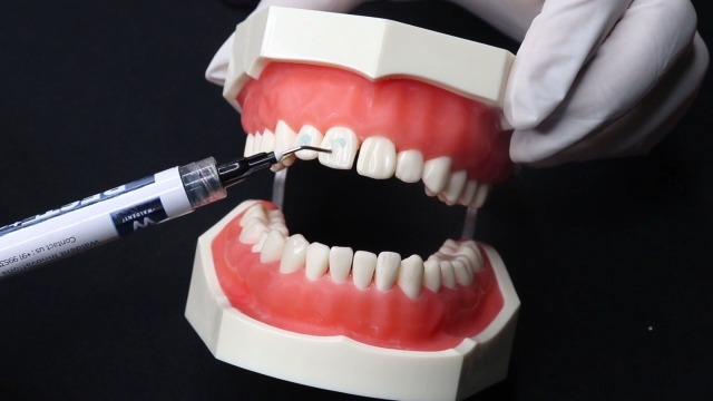 10 Sets De Brackets Céramique Orthodontie MBT 022 Avec 3/4/5 Crochets - Marque Skysea