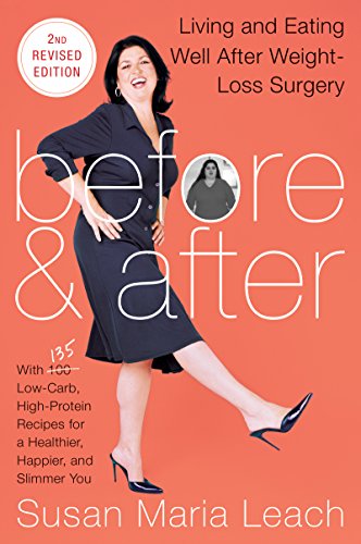 Before & After, Second Revised Edition: Living and Eating Well After Weight-Loss Surgery Before & After, Second Revised Edition: Living and Eating Well After Weight-Loss Surgery