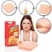 Imagen de GOODS+GADGETS Pimple Popper