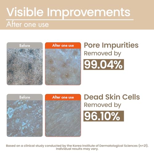 Image of Papa Recipe Blemish Enzyme Powder Cleanser (3 Pack) - Travel-Friendly Korean Powder-to-Foam Face Wash, Rice Powder for Radiant-Looking Skin, Gentle Exfoliation, Smooth Texture & Pore Care