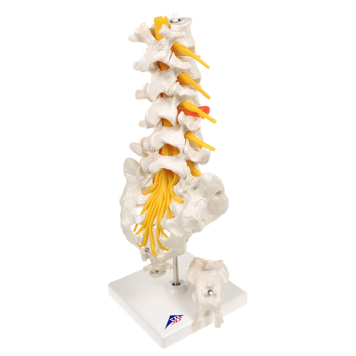 3B Scientific A76/5 Colonna Vertebrale Lombare con Ernia del Disco Dorsolaterale + software gratuito di anatomia - 3B Smart Anatomy